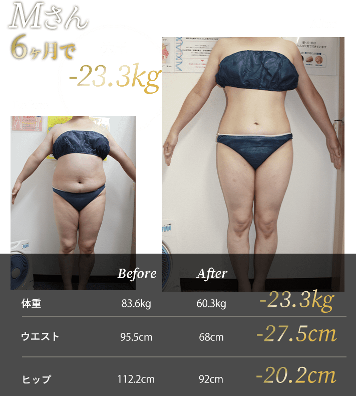 Mさん6ヶ月で体重-23.3kg