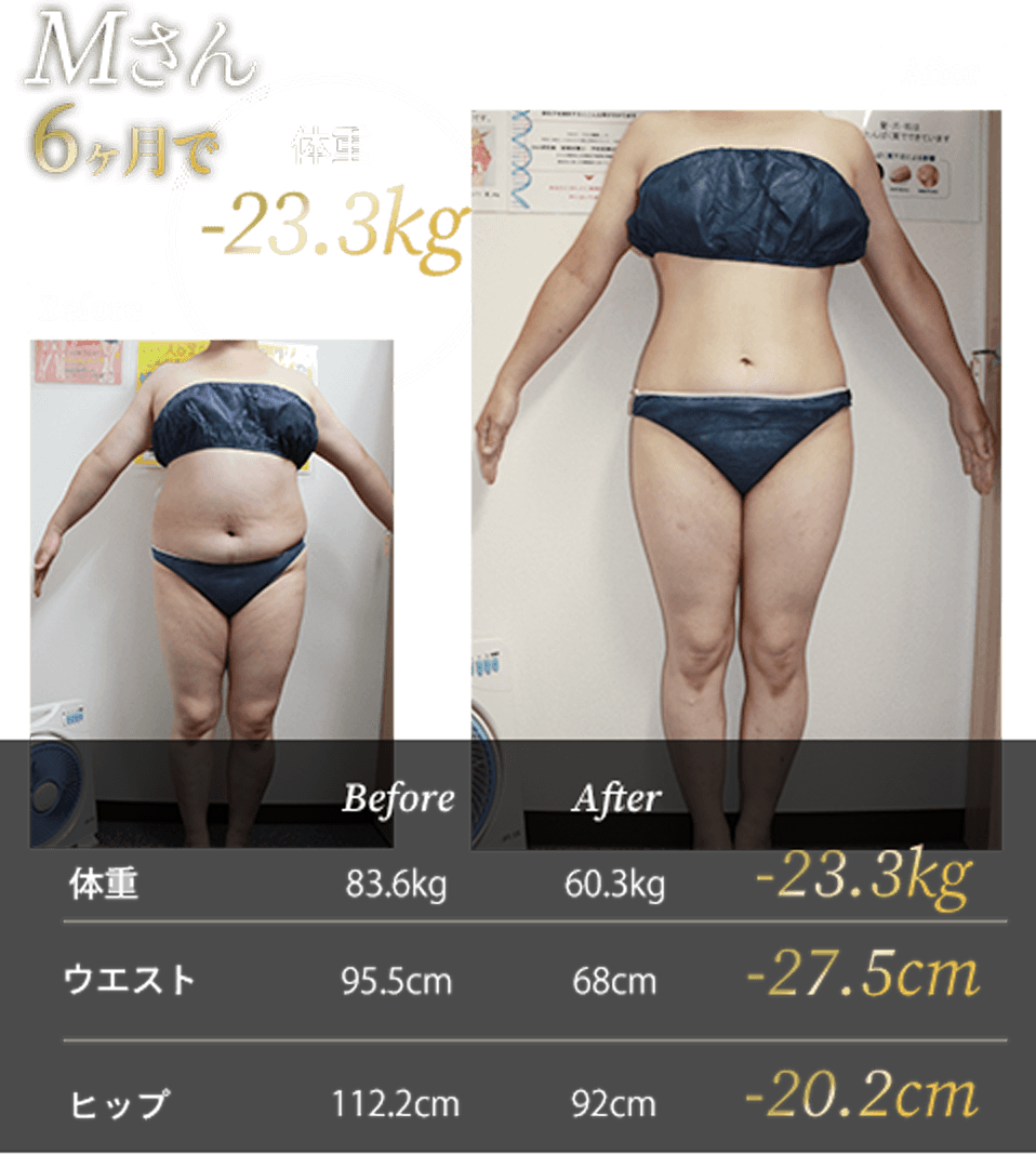 Mさん6ヶ月で体重-23.3kg