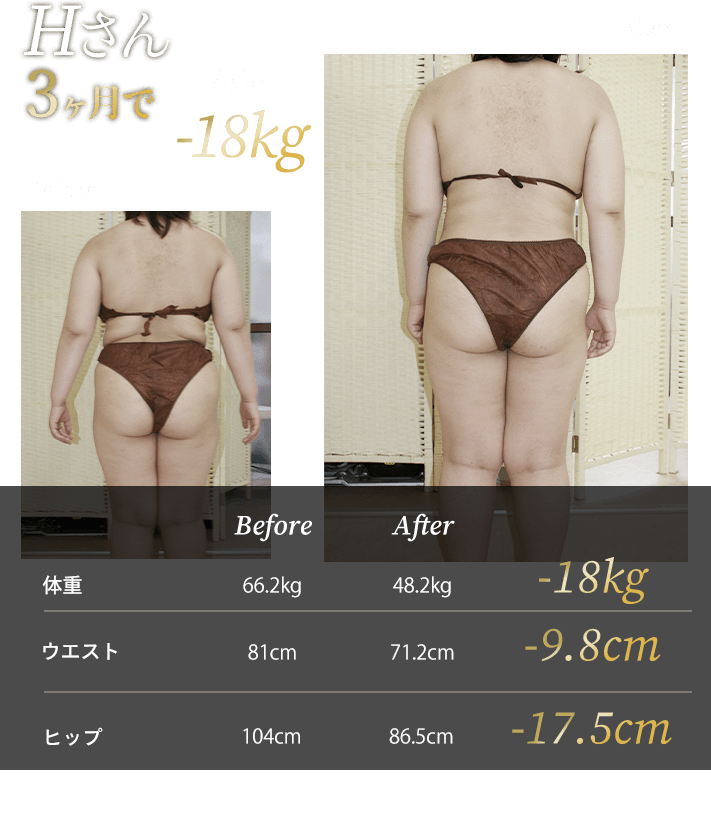 Hさん3ヶ月で体重-18kg
