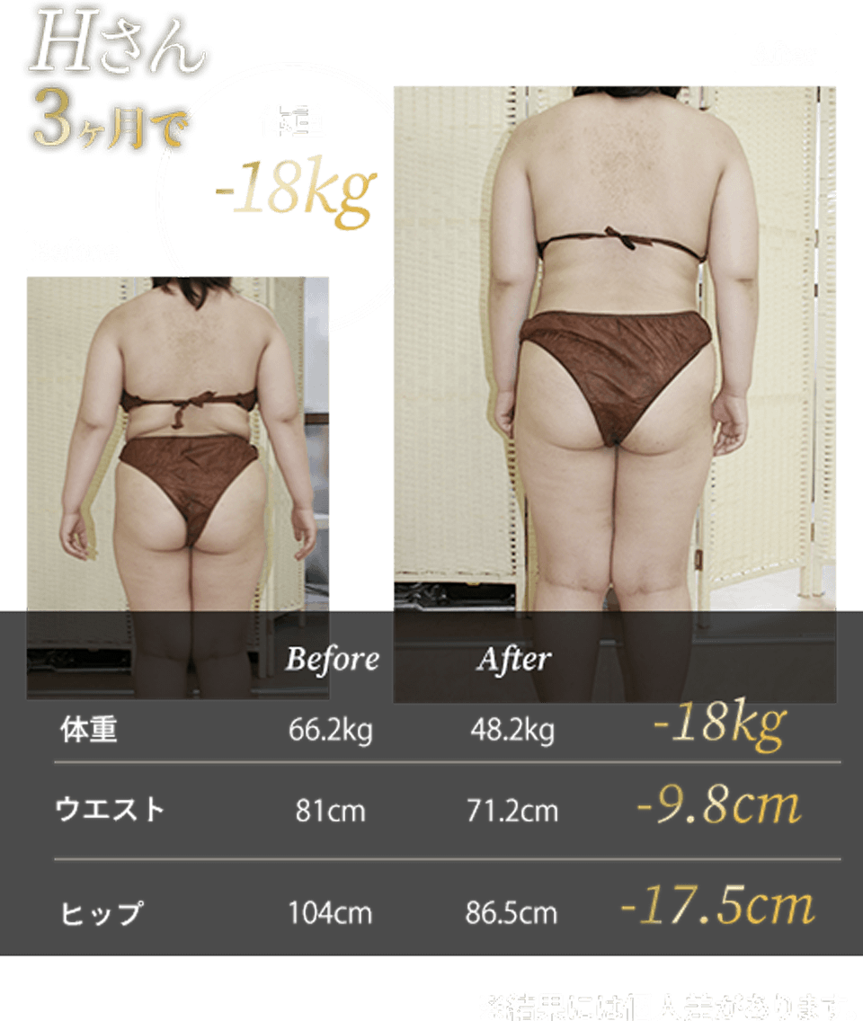 Hさん3ヶ月で体重-18kg